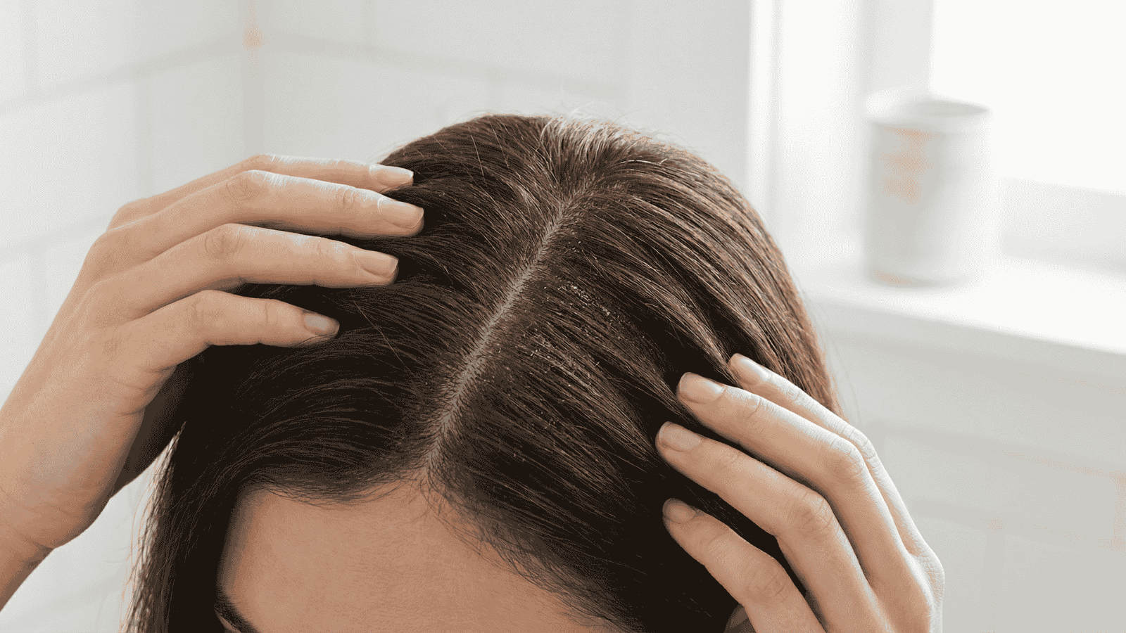 Close-up of scalp with hair parted, showing product buildup near roots